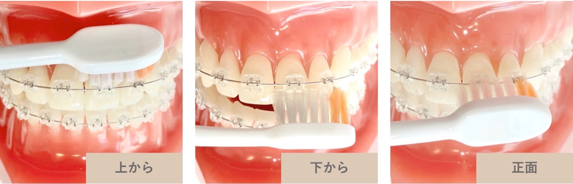 歯ブラシの当て方