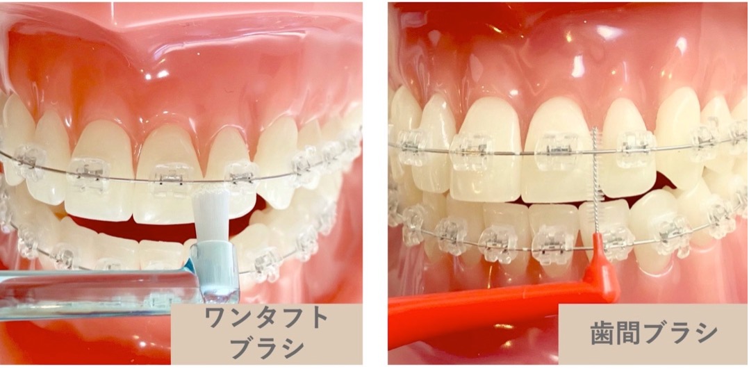 ワンタフトブラシ・歯間ブラシ