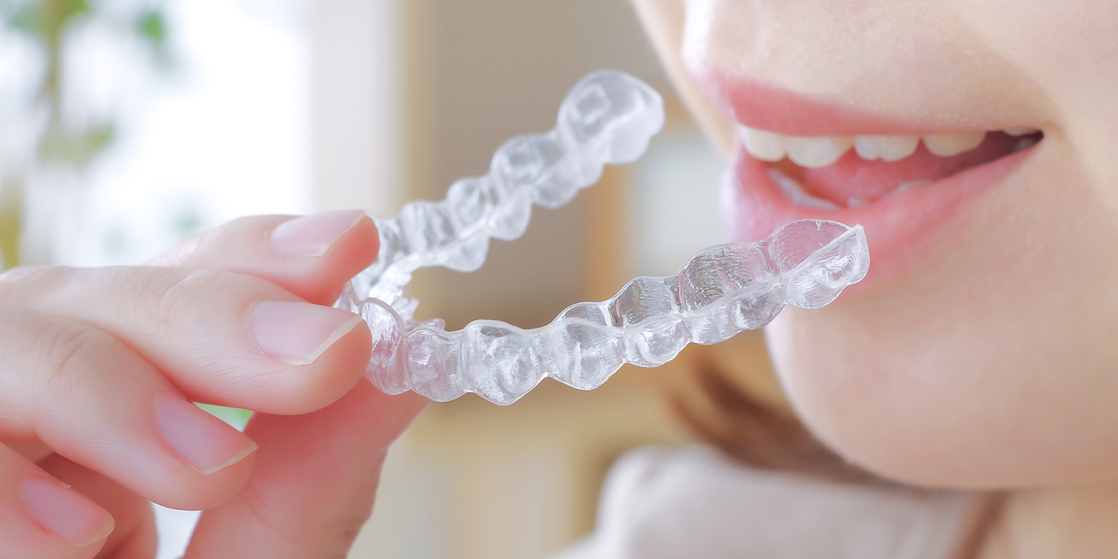 矯正治療の種類