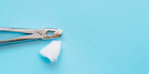 八重歯矯正に抜歯は必要？