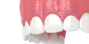 原因別の治療法