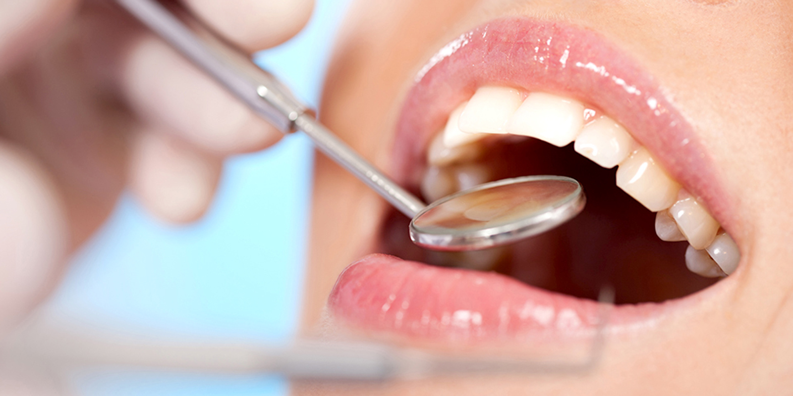 後悔しないためにはしっかり事前準備を